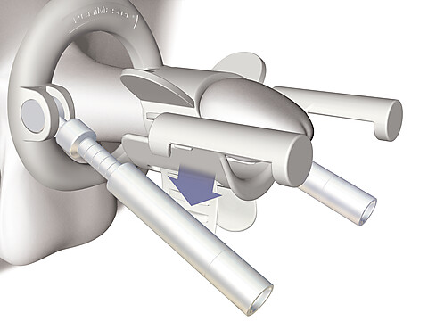 Çubukların tutma yüzeyine alttan klipslenmesini gösteren şekil