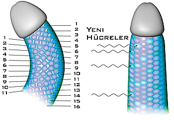 Funktionsbild der Begradigung des Penis mit PeniMaster